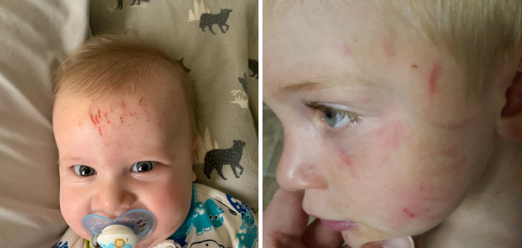How To Stop Toddler From Watching Tv While Eating